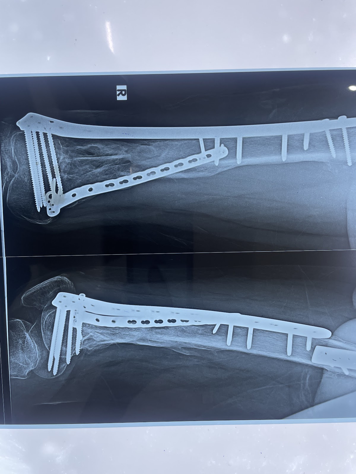 Dr pranab pegu, MS, Orthopedic surgeon